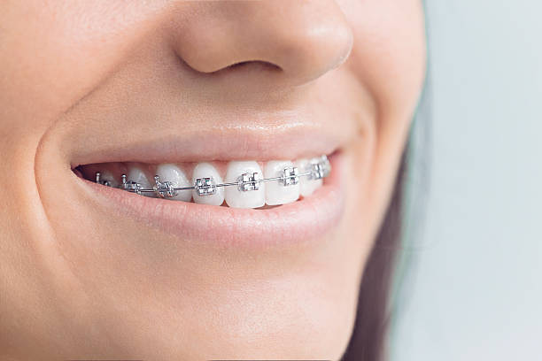 Best Wisdom Tooth Removal  in Huntland, TN